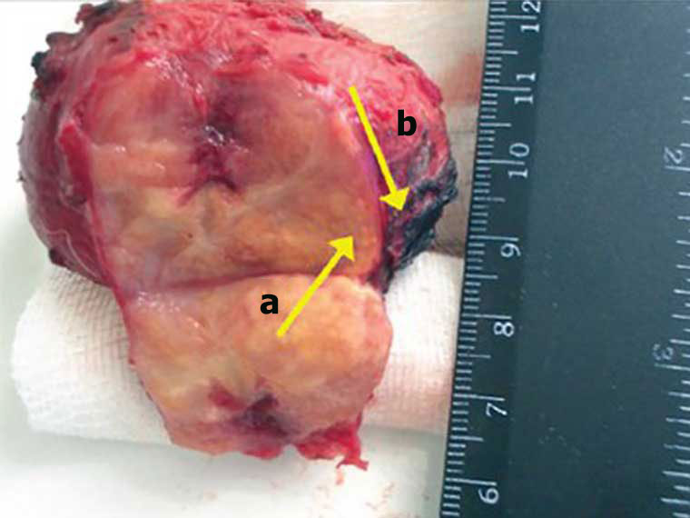 Reprostat